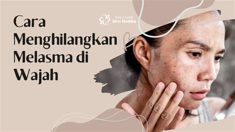 5 Tips Ampuh Hilangkan Melasma di Wajah dalam 2 Minggu!