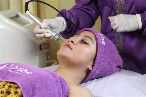 7 Fakta Biaya Laser Wajah 2024: Habis Berapa Juta?