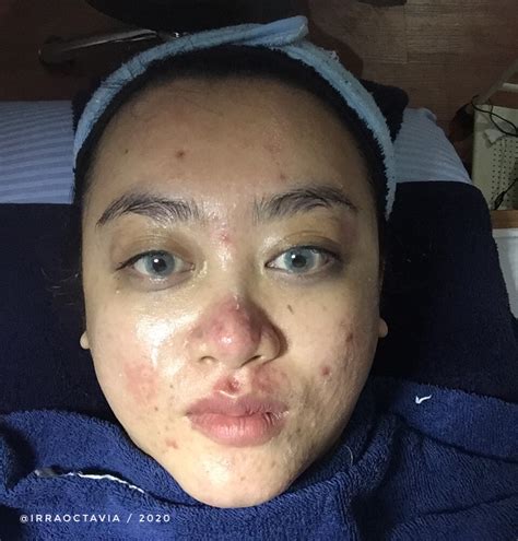 7 Langkah Mudah: Cara Facial Wajah Glowing di Rumah!