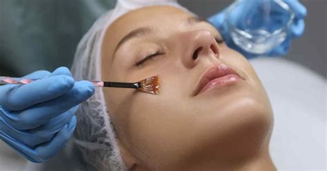 7 Treatment Peeling Wajah yang Bikin Kulitmu Terlihat Mulus dan Awet Muda!