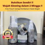 5 Paket Perawatan Wajah di MS Glow dengan Harga Mulai Rp500.000 yang Bisa Bikin Kulitmu Glowing!