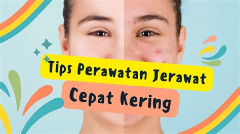 7 Rahasia Ampuh Basmi Jerawat: Kulit Mulus dalam Seminggu! 7 Rahasia Ampuh Basmi Jerawat: Kulit Mulus dalam Seminggu!
