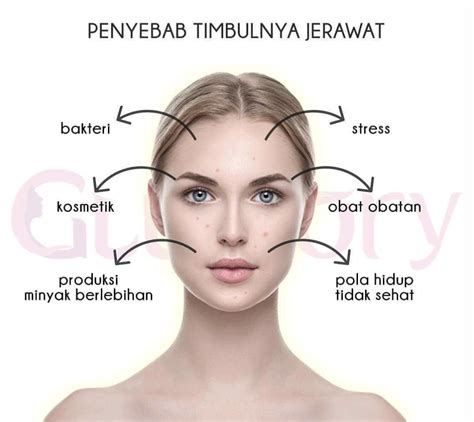 7 Rahasia Ampuh Basmi Jerawat: Kulit Mulus dalam Seminggu! 7 Rahasia Ampuh Basmi Jerawat: Kulit Mulus dalam Seminggu!