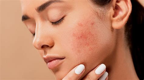 7 Rahasia Kulit Glowing Bebas Kering: Bye-Bye Kulit Kusam! 7 Rahasia Kulit Glowing Bebas Kering: Bye-Bye Kulit Kusam!