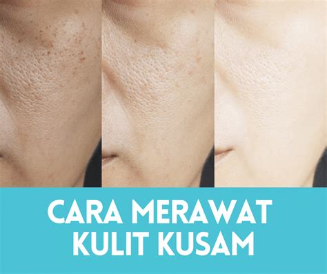 7 Rahasia Kulit Kering Jadi Glowing, Nomor 5 Bikin Kaget!