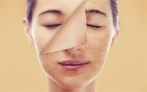 7 Rahasia Kulit Kering Jadi Glowing, Nomor 5 Bikin Kaget!
