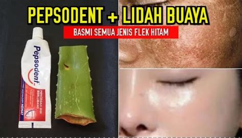 5 Bahan Alami Ampuh Hilangkan Komedo, Bikin Wajah Cerah! 5 Bahan Alami Ampuh Hilangkan Komedo, Bikin Wajah Cerah!