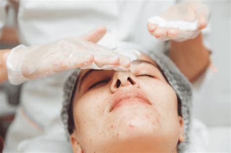 5 Bahan Alami Ampuh Hilangkan Komedo, Bikin Wajah Cerah! 5 Bahan Alami Ampuh Hilangkan Komedo, Bikin Wajah Cerah!