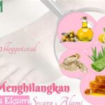5 Hal Ajaib untuk Hilangkan Eksim dalam 7 Hari!