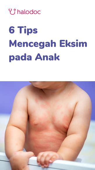 5 Hal Ajaib untuk Hilangkan Eksim dalam 7 Hari! 5 Hal Ajaib untuk Hilangkan Eksim dalam 7 Hari!