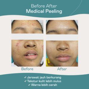 5 Paket Facial Anti-Aging Bikin Kulit Kinclong Kayak Artis! 😱