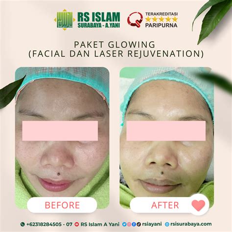 5 Paket Facial Anti-Aging Bikin Kulit Kinclong Kayak Artis! 😱