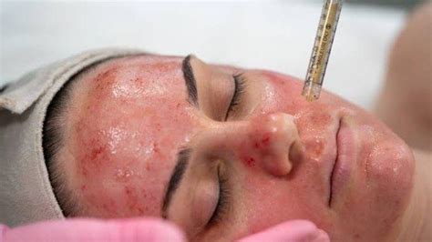 5 Paket Facial Anti-Aging Bikin Kulit Kinclong Kayak Artis! 😱