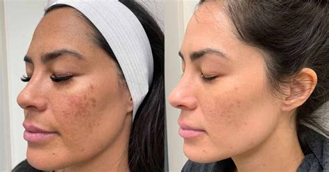 5 Paket Facial Anti-Aging Bikin Kulit Kinclong Kayak Artis! 😱