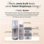 5 Produk MS Glow untuk Kulit Berminyak: Bye-bye Kilap!