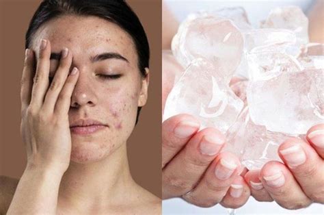 5 Tips Ampuh Atasi Jerawat Meradang Dalam Semalam! 5 Tips Ampuh Atasi Jerawat Meradang Dalam Semalam!