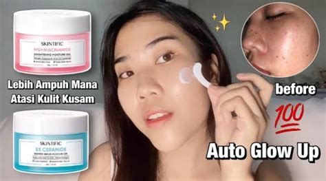 7 MOISTURIZER AJAIB Selamatkan Kulit Wajah Keringmu! 7 MOISTURIZER AJAIB Selamatkan Kulit Wajah Keringmu!