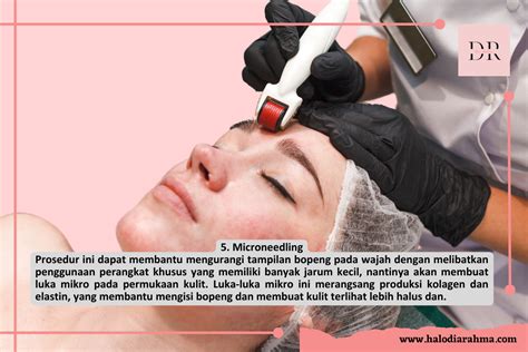 7 Perawatan Bopeng Dermaster Terbaik: Bye-Bye Kulit Tak Rata! 7 Perawatan Bopeng Dermaster Terbaik: Bye-Bye Kulit Tak Rata!