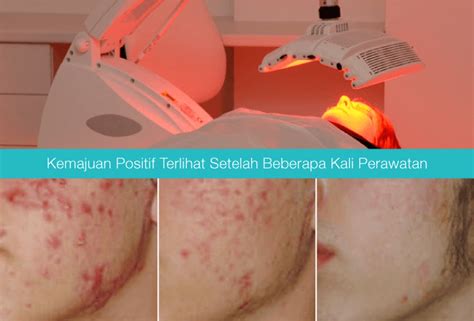 7 Perawatan Wajib di Larissa untuk Kulit Glowing Alami! 7 Perawatan Wajib di Larissa untuk Kulit Glowing Alami!