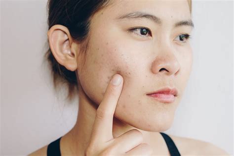 7 Perawatan Wajib di Larissa untuk Kulit Glowing Alami! 7 Perawatan Wajib di Larissa untuk Kulit Glowing Alami!
