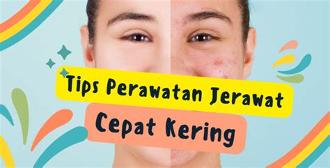 7 Rahasia Kulit Mulus Bebas Jerawat: Buktikan Sendiri! 7 Rahasia Kulit Mulus Bebas Jerawat: Buktikan Sendiri!