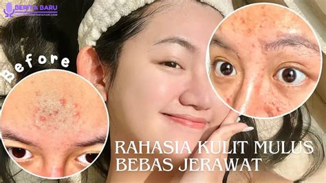 7 Rahasia Kulit Mulus Bebas Jerawat: Buktikan Sendiri!