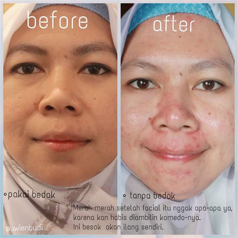 7 Rahasia Perawatan Badan di Erha yang Bikin Kulit Glowing dalam 7 Hari! 7 Rahasia Perawatan Badan di Erha yang Bikin Kulit Glowing dalam 7 Hari!
