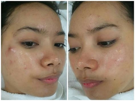 7 Rahasia Perawatan Badan di Natasha yang Bikin Kulit Glowing Seketika! 7 Rahasia Perawatan Badan di Natasha yang Bikin Kulit Glowing Seketika!