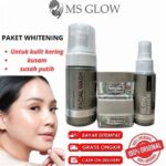 7 Tips Menggunakan Paket Perawatan MS Glow untuk Mendapatkan Kulit Mulus dalam 30 Hari!